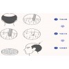 贵阳做疤痕植发后会脱落吗?
